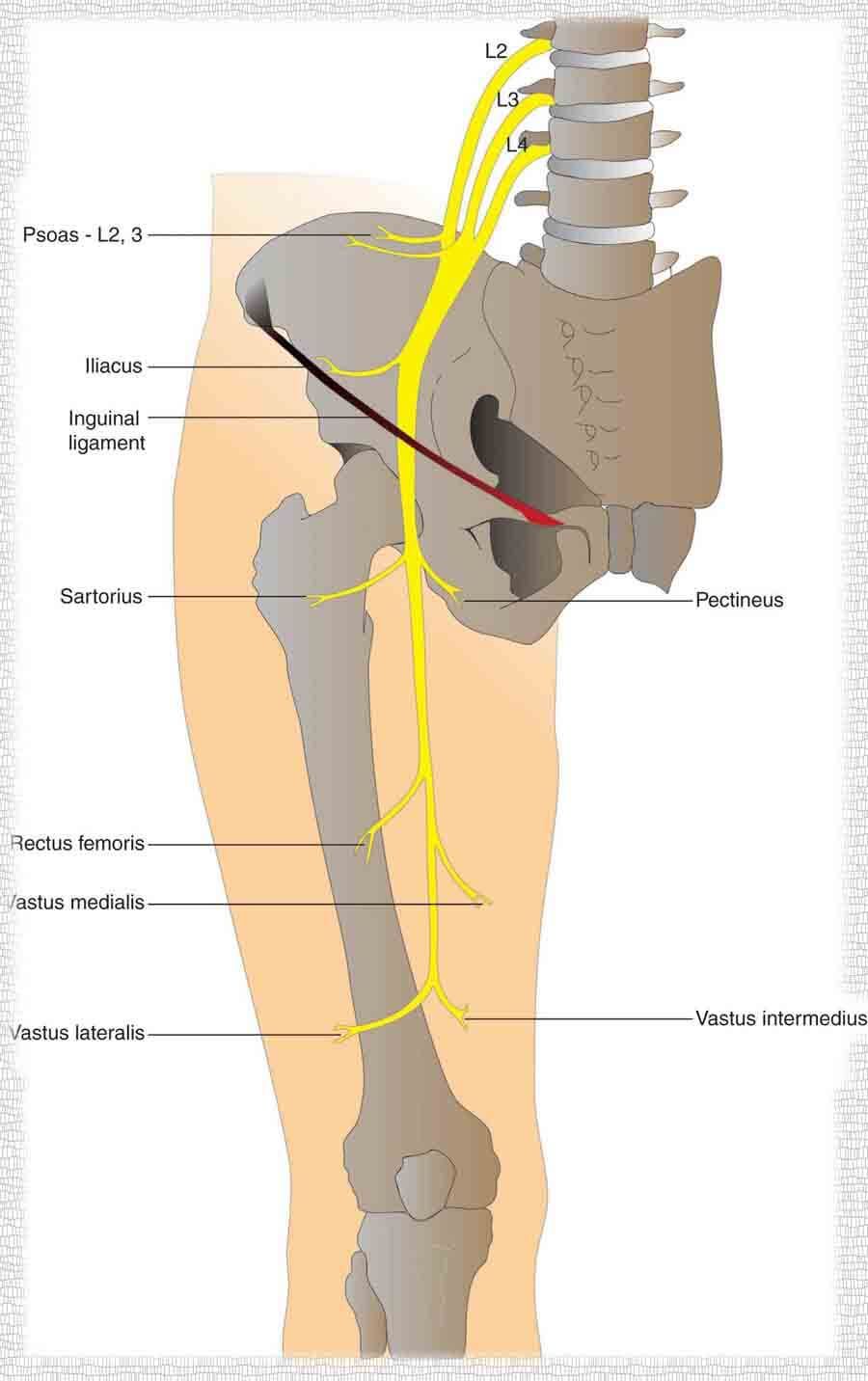Femoral sinir (kasık siniri) sıkışması